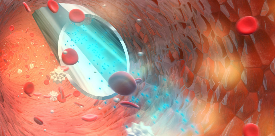 Animation